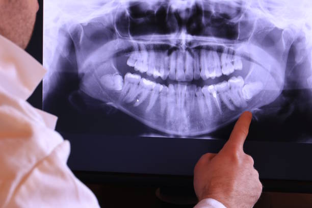 Best Emergency Treatment for Jaw Pain or Injury in Bethany, WV