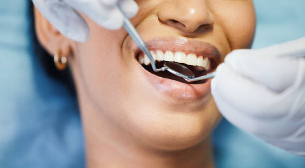 Best Emergency Wisdom Tooth Extraction in Bethany, WV
